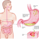 Illustration for article titled Obat Maag Herbal Yang Ampuhem/em